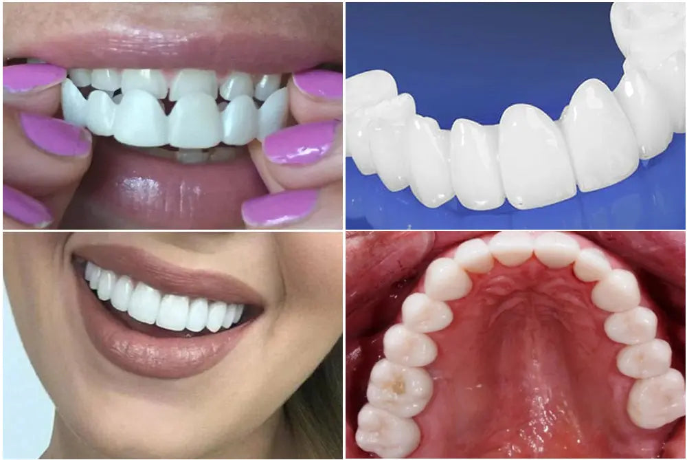 Regulowane soczewki dentystyczne Kup 1, Otrzymaj 2 Marlene Polônia S/ video